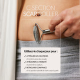 ROLEAU POUR CÉSARIENNE - WE ARE MAMMAS FRANCE